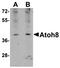 Atonal BHLH Transcription Factor 8 antibody, orb75173, Biorbyt, Western Blot image 