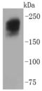 DYSF antibody, A01234-2, Boster Biological Technology, Western Blot image 