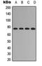 Forkhead Box O1 antibody, orb315783, Biorbyt, Western Blot image 