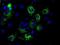 Mitochondrial Translational Release Factor 1 Like antibody, NBP2-02384, Novus Biologicals, Immunofluorescence image 