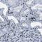 PHD Finger Protein 14 antibody, FNab06381, FineTest, Immunohistochemistry paraffin image 