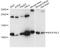NDUFA4 Mitochondrial Complex Associated Like 2 antibody, A14288, ABclonal Technology, Western Blot image 