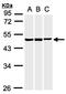 Cholinergic Receptor Nicotinic Alpha 2 Subunit antibody, orb13597, Biorbyt, Western Blot image 
