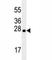 Latexin antibody, F40247-0.4ML, NSJ Bioreagents, Western Blot image 