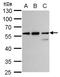 CLN3 Lysosomal/Endosomal Transmembrane Protein, Battenin antibody, NBP2-43782, Novus Biologicals, Western Blot image 