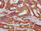 Hook Microtubule Tethering Protein 3 antibody, CSB-PA769790LA01HU, Cusabio, Immunohistochemistry frozen image 
