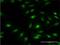 F-Box Protein 7 antibody, H00025793-M01, Novus Biologicals, Immunocytochemistry image 
