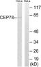 Centrosomal Protein 78 antibody, LS-C119837, Lifespan Biosciences, Western Blot image 