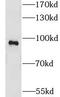 Leucine Rich Repeat Containing 41 antibody, FNab04857, FineTest, Western Blot image 