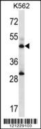 Adenylosuccinate synthetase isozyme 2 antibody, 56-848, ProSci, Western Blot image 