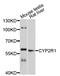 Cytochrome P450 Family 2 Subfamily R Member 1 antibody, abx125744, Abbexa, Western Blot image 