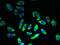Sodium/glucose cotransporter 2 antibody, LS-C396735, Lifespan Biosciences, Immunofluorescence image 