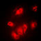 Aurora Kinase A antibody, LS-C354094, Lifespan Biosciences, Immunofluorescence image 
