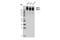 ATP Binding Cassette Subfamily C Member 1 antibody, 72202S, Cell Signaling Technology, Western Blot image 