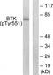 ATK antibody, TA313378, Origene, Western Blot image 