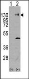 Platelet Derived Growth Factor Receptor Alpha antibody, AP14392PU-N, Origene, Western Blot image 