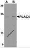 Placenta-specific protein 4 antibody, 6021, ProSci, Western Blot image 