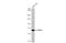 Neuraminidase antibody, GTX636993, GeneTex, Western Blot image 