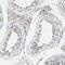 Zinc Finger Protein 184 antibody, PA5-51866, Invitrogen Antibodies, Immunohistochemistry frozen image 