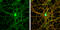Glutamate Ionotropic Receptor NMDA Type Subunit 2B antibody, GTX109713, GeneTex, Immunofluorescence image 