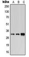 Carbonic anhydrase VI antibody, orb213629, Biorbyt, Western Blot image 