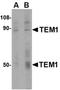 CD248 Molecule antibody, orb74895, Biorbyt, Western Blot image 