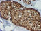 Metalloproteinase inhibitor 2 antibody, M01037-2, Boster Biological Technology, Immunohistochemistry paraffin image 