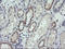 Cancer/Testis Antigen 1B antibody, LS-C174619, Lifespan Biosciences, Immunohistochemistry paraffin image 