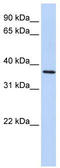 F-Box Protein 8 antibody, TA334443, Origene, Western Blot image 