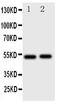 Nuclear Receptor Subfamily 5 Group A Member 1 antibody, PA2062, Boster Biological Technology, Western Blot image 