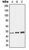Glucosaminyl (N-Acetyl) Transferase Family Member 7 antibody, LS-C353636, Lifespan Biosciences, Western Blot image 