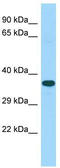 Coiled-Coil Domain Containing 9B antibody, TA331492, Origene, Western Blot image 