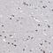 Abhydrolase Domain Containing 10 antibody, HPA036991, Atlas Antibodies, Immunohistochemistry frozen image 