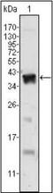 Androgen Receptor antibody, orb89428, Biorbyt, Western Blot image 