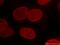 Lamin B1 antibody, YF594-66095, Proteintech Group, Immunofluorescence image 