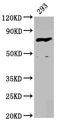 Coagulation Factor XIII B Chain antibody, LS-C680433, Lifespan Biosciences, Western Blot image 