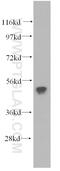 Fc Fragment Of IgG Receptor IIa antibody, 15625-1-AP, Proteintech Group, Western Blot image 