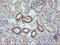 RAB21, Member RAS Oncogene Family antibody, M05683-1, Boster Biological Technology, Immunohistochemistry paraffin image 