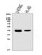 HLA class I histocompatibility antigen, A-2 alpha chain antibody, PB9376, Boster Biological Technology, Western Blot image 