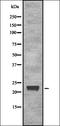 ETS Variant 2 antibody, orb337291, Biorbyt, Western Blot image 
