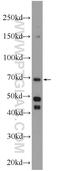 Ectonucleoside Triphosphate Diphosphohydrolase 7 antibody, 24558-1-AP, Proteintech Group, Western Blot image 