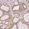 Round Spermatid Basic Protein 1 antibody, PA5-61986, Invitrogen Antibodies, Immunohistochemistry frozen image 