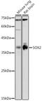 SRY-Box 2 antibody, GTX32891, GeneTex, Western Blot image 