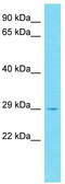 Peroxisomal membrane protein 11C antibody, TA331673, Origene, Western Blot image 