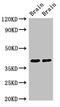 Stomatin Like 3 antibody, CSB-PA844707LA01HU, Cusabio, Western Blot image 