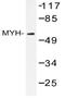 MutY DNA Glycosylase antibody, AP20553PU-N, Origene, Western Blot image 