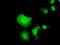 Chromosome 16 Open Reading Frame 72 antibody, GTX84757, GeneTex, Immunofluorescence image 