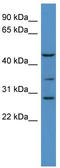 Beta-1,3-Galactosyltransferase 2 antibody, TA338206, Origene, Western Blot image 
