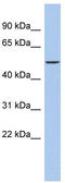 DALR Anticodon Binding Domain Containing 3 antibody, TA336132, Origene, Western Blot image 