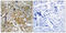 Alpha-PAK antibody, 79-818, ProSci, Immunohistochemistry paraffin image 